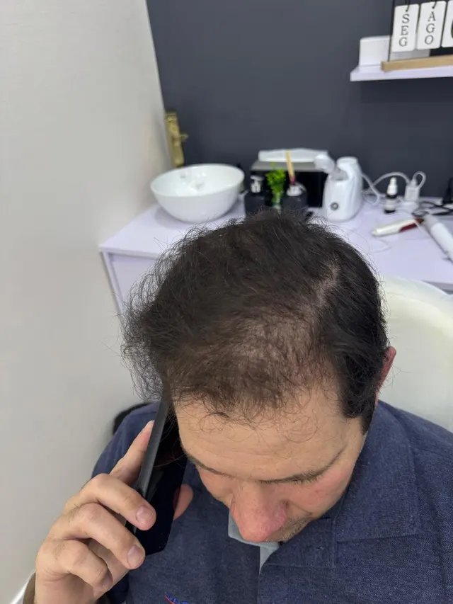 Depois de 3 meses, paciente Cristiano