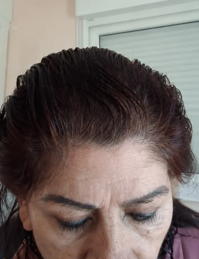 Depois de 5 meses, paciente Fátima