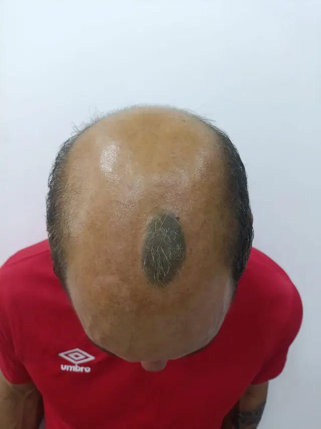 Antes do tratamento, paciente Silvano