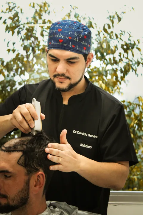 Dr. Denildo durante procedimento de transplante capilar