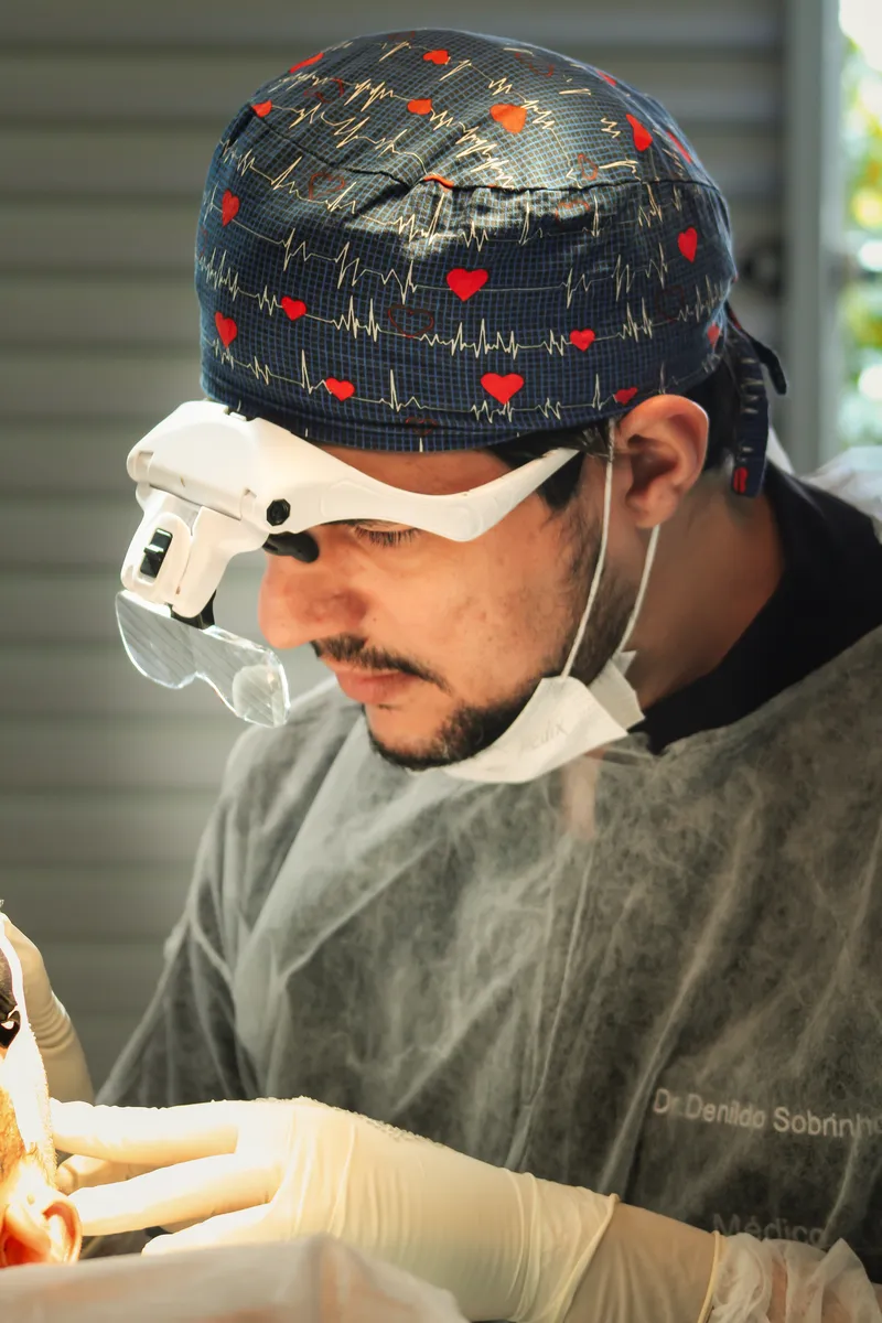 Dr. Denildo durante procedimento de transplante capilar
