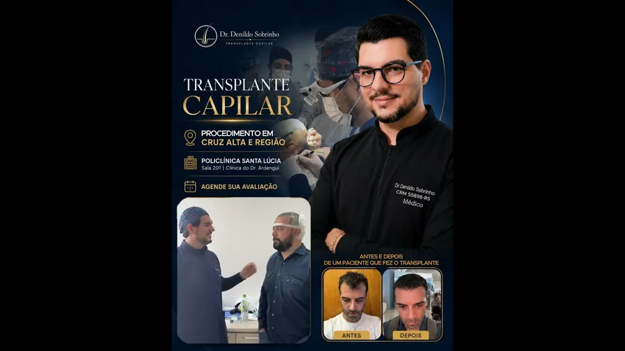 Prévia do vídeo do procedimento de transplante capilar